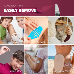 Skinister Medical Adhesive Remover - Image 2