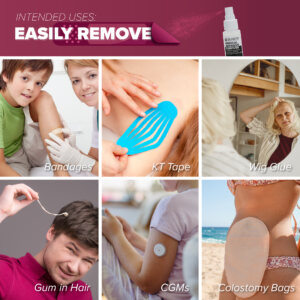 Hybrid Medical Adhesive Remover Wipes – Silicone Adhesive Remover for Skin | Ostomy, Wig, Tape & Bandage Adhesive Remover | 50 Dry Wipes + 2oz Spray Solution - Image 3