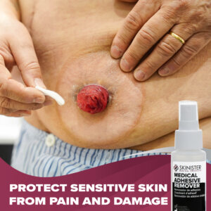 Skinister Medical Adhesive Remover - Image 5