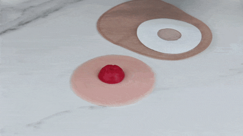 Applying the ostomy bag after using Skinister adhesive
