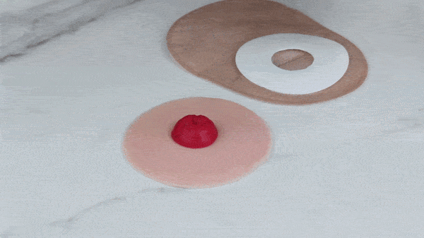 Applying Skinister adhesive to the skin around the stoma